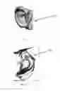 Fig. 09 - Method of manufacture of a surgical model for an anatomical feature