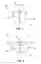 Fig. 05 - Injection molding device for thick lenses and method of manufacturing