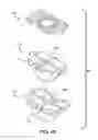 Fig. 52 - Injection molding device for thick lenses and method of manufacturing