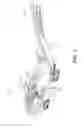 Fig. 02 - CANOPY ASSEMBLY