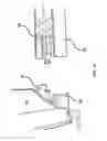 Fig. 09 - Apparatus for drive shaft extension