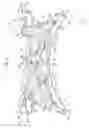 Fig. 03 - Subframe for vehicle