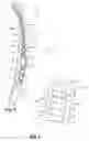 Fig. 03 - Lateral upright for motor vehicle body shell