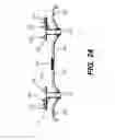 Fig. 24 - Tunnel guard for a snowmobile