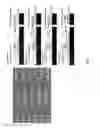 Fig. 05 - Micro-nano hierarchical structure for drag reduction and microbial adhesion prevention and marine structure comprising the same