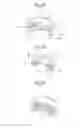 Fig. 10 - VENTILATION MEMBER, METHOD FOR PRODUCING VENTILATION MEMBER, AND VENTILATION CONTAINER
