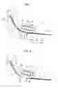 Fig. 06 - Paper feeding device