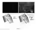 Fig. 08 - Reagents and methods for treating dental disease