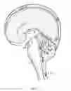 Fig. 03 - Methods and device to neutralize soluble toxic agents in the brain
