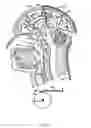 Fig. 05 - Methods and device to neutralize soluble toxic agents in the brain