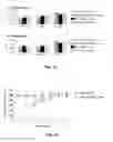 Fig. 16 - Methods and device to neutralize soluble toxic agents in the brain