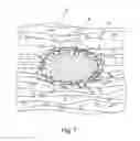 Fig. 02 - Process for producing cellulosic shaped articles, cellulosic shaped articles and the use thereof