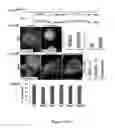 Fig. 05 - Methods of maintaining, expanding and differentiating neuronal subtype specific progenitors