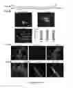 Fig. 07 - Methods of maintaining, expanding and differentiating neuronal subtype specific progenitors