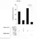 Fig. 17 - Regulatory B cells (tBREGS) and their use