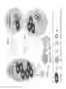 Fig. 25 - Regulatory B cells (tBREGS) and their use