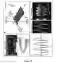 Fig. 15 - Cortical Bone-Derived Stem Cells