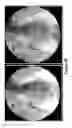 Fig. 29 - Cortical Bone-Derived Stem Cells