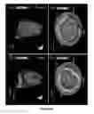 Fig. 30 - Cortical Bone-Derived Stem Cells