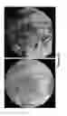 Fig. 31 - Cortical Bone-Derived Stem Cells