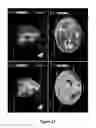 Fig. 32 - Cortical Bone-Derived Stem Cells