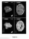 Fig. 33 - Cortical Bone-Derived Stem Cells