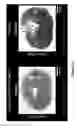 Fig. 34 - Cortical Bone-Derived Stem Cells