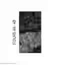 Fig. 05 - ENDOGENOUS EXPRESSION OF HLA-G AND/OR HLA-E BY MESENCHYMAL CELLS