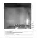 Fig. 11 - ENDOGENOUS EXPRESSION OF HLA-G AND/OR HLA-E BY MESENCHYMAL CELLS