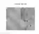 Fig. 13 - ENDOGENOUS EXPRESSION OF HLA-G AND/OR HLA-E BY MESENCHYMAL CELLS