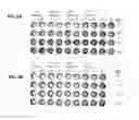 Fig. 06 - Method for selecting polynucleotides encoding antigen-specific immunoglobulin subunits