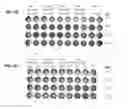 Fig. 07 - Method for selecting polynucleotides encoding antigen-specific immunoglobulin subunits