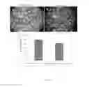 Fig. 14 - COMPOUND ADMINISTRATION PRECURSOR AND MEDICAMENT CARRIER PREPARATION