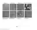 Fig. 16 - COMPOUND ADMINISTRATION PRECURSOR AND MEDICAMENT CARRIER PREPARATION
