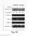 Fig. 10 - Treating cancer deficient in FANCA, FANCD2, FANCE, or FANCG with an ATM inhibitor