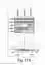 Fig. 44 - Treating cancer deficient in FANCA, FANCD2, FANCE, or FANCG with an ATM inhibitor