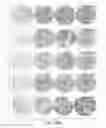 Fig. 45 - Treating cancer deficient in FANCA, FANCD2, FANCE, or FANCG with an ATM inhibitor