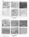 Fig. 49 - Treating cancer deficient in FANCA, FANCD2, FANCE, or FANCG with an ATM inhibitor
