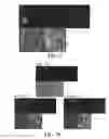 Fig. 14 - Compositions and methods for efficacious and safe delivery of siRNA using specific chitosan-based nanocomplexes