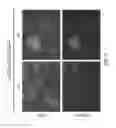 Fig. 05 - Non-toxic HSV vectors for efficient gene delivery applications and complementing cells for their production