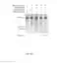 Fig. 06 - Delivery and use of the CRISPR-Cas systems, vectors and compositions for hepatic targeting and therapy