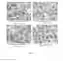Fig. 120 - Delivery and use of the CRISPR-Cas systems, vectors and compositions for hepatic targeting and therapy