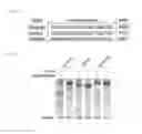 Fig. 135 - Delivery and use of the CRISPR-Cas systems, vectors and compositions for hepatic targeting and therapy