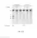 Fig. 45 - Delivery and use of the CRISPR-Cas systems, vectors and compositions for hepatic targeting and therapy