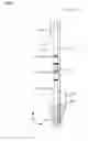 Fig. 12 - INSPECTION TOOL FOR NUCLEIC ACID CHROMATOGRAPHY