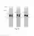 Fig. 18 - Specific nucleic acid amplification with compounded selectivity