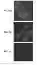 Fig. 02 - Method for the cytological analysis of cervical cells