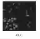 Fig. 03 - Method for the cytological analysis of cervical cells