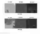 Fig. 09 - Method for the cytological analysis of cervical cells