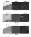 Fig. 10 - Method for the cytological analysis of cervical cells